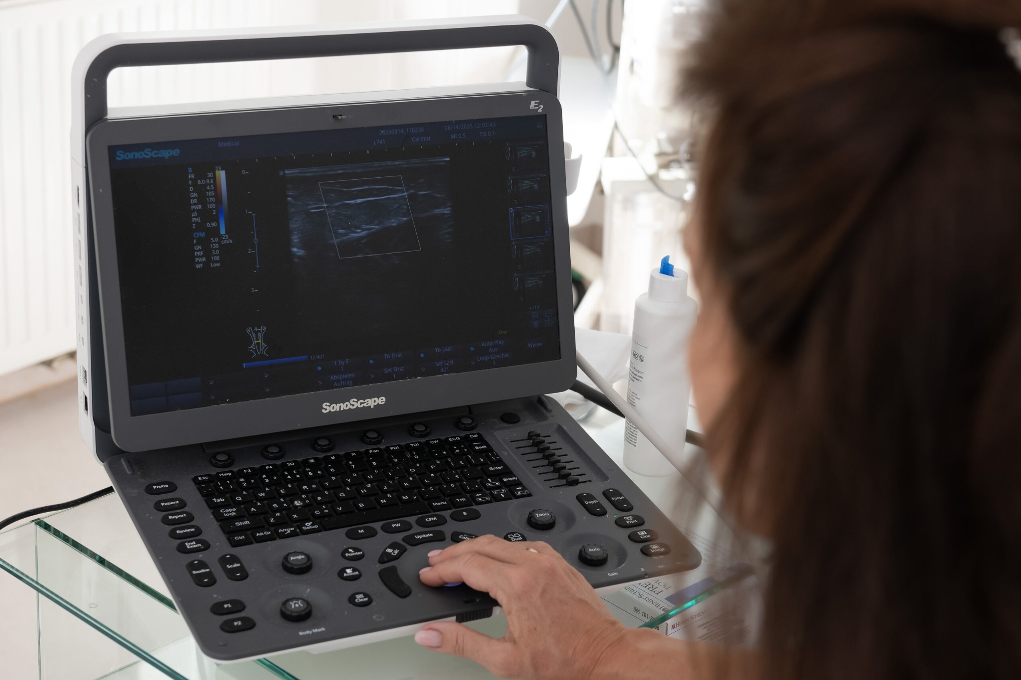 Ultraschall für Venenstatus in Wien